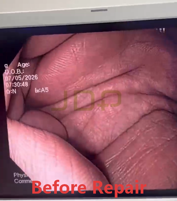 OLYMPUS CF-H180AL Electronic Colonoscope For Repair