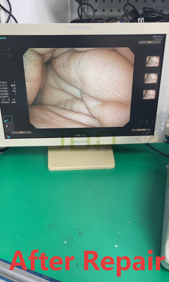 SonoScape EG-500 Electronic Gastroscopy For Repair