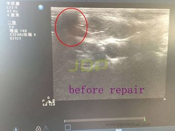 L12-5 probe for repair