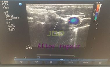 L12-5 probe for repair